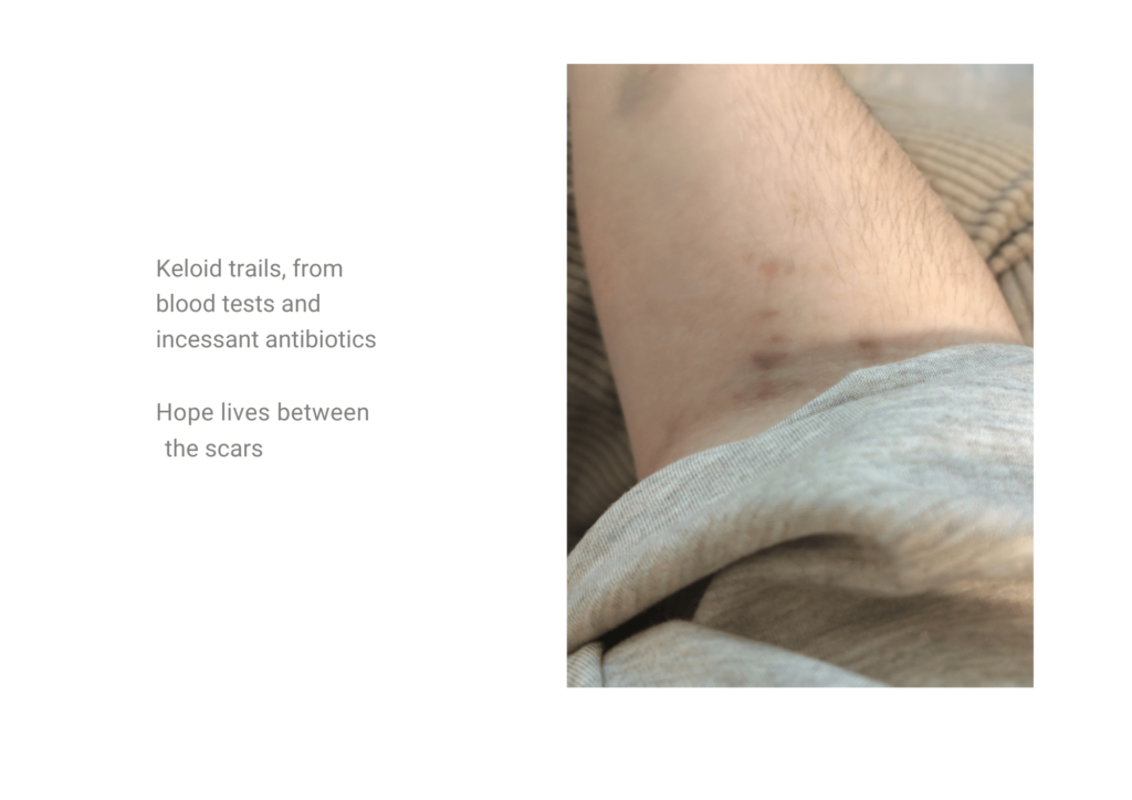On the right, a photo of Dianna's arm. Text on the left reads: "Keloid trails from blood tests and incessant antibiotics. Hope lives between the scars"